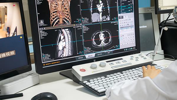 Cardiac Abnormalities Seen After COVID-19, but Recovery Is Quick 